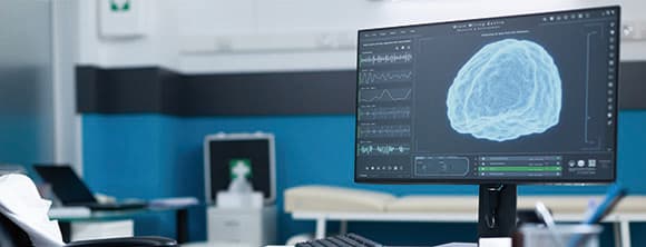 TMS(경두개 자기자극술)